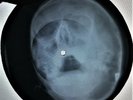 Rolling Stones - Mother'S Little Helper X-RAY USSR ROENTGEN Bones Record SKULL