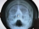 Beatles - Please Please Me X-RAY USSR ROENTGEN Bones Records SKULL