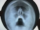 Beatles - Hello Goodbye X-RAY USSR ROENTGEN Bones Record SKULL