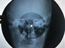 Queen - Bohemian Rhapsody X-RAY USSR ROENTGEN Bones Records SKULL