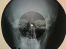 4pcs  X-RAY USSR ROENTGEN Bones Records