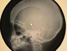 Chuck Berry - You Never Can Tell X-RAY USSR ROENTGEN Bones Records SKULL