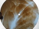ROLLING STONES - POISON IVY - UNIQUE USSR GEORGIAN X-RAY ROENTGEN RIBS RECORD