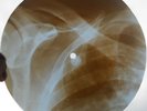 BOB DYLAN - WITH GOD ON OUR SIDE - USSR GEORGIAN X-RAY ROENTGEN RIBS RECORD