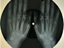 Elvis Presley - What'd I Say X-RAY USSR ROENTGEN Bones Records HANDS