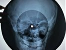3pcs  X-RAY USSR ROENTGEN Bones Records