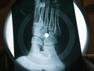 Elvis Presley Blue Suede Shoes X Ray USSR Vinyl Record Music on Bones Roentgen
