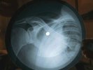 Stooges No Fun X Ray USSR Vinyl Record Music on Bones Roentgen