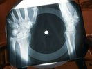 Led Zeppelin Communication Break X Ray USSR Vinyl Record Music on Bones Roentgen