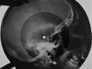 Beatles - And I Love Her X-RAY USSR ROENTGEN Bones Records SKULL