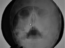 Frank Ifield - Lucky Devil X-RAY USSR ROENTGEN Bones Records SKULL