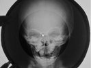 Rolling Stones - Route 66 X-RAY USSR ROENTGEN Bones Records SKULL