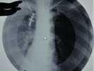 Rolling Stones - Come on X-RAY USSR ROENTGEN Bones Records