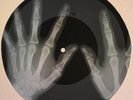 Chuck Berry - Brown Eyed Handsome Man X-RAY USSR ROENTGEN Bones Records