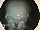 Beatles - Boys X-RAY USSR ROENTGEN Bones Records SKULL