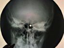 Beatles - Oh  Darling  X-RAY USSR ROENTGEN Bones Records SKULL
