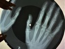 Beatles - Tell Me Why X-RAY USSR ROENTGEN Bones Records HANDS