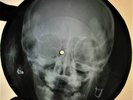 Beatles - Baby It's You X-RAY USSR ROENTGEN Bones Records SKULL