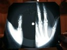 Pink Floyd Astronomy Domine X Ray USSR Vinyl Record Music on Bones Roentgen