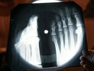 Velvet Underground Sunday Mornin X Ray USSR Vinyl Record Music on Bones Roentgen