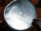 David Bowie Superman X Ray USSR Vinyl Record Music on Bones Roentgen