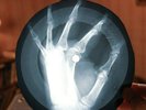 Neil Diamond Sweet Caroline X-Ray USSR Vinyl Record Music on Bones Roentgen