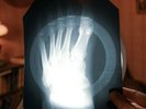 Neil Diamond Cherry Cherry X-Ray USSR Vinyl Record Music on Bones Roentgen