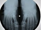 Velvet Underground - The Black Angel`s Death Song X-RAY USSR ROENTGEN Bones