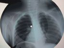 Beatles - The Word X-RAY USSR ROENTGEN Bones Records