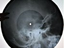 Bob Marley - Get Up Stand Up X-RAY USSR ROENTGEN Bones Records SKULL