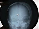Rolling Stones - Stoned X-RAY USSR ROENTGEN Bones Records SKULL