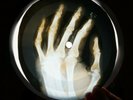 BEACH BOYS I CAN HEAR MUSIC X-RAY USSR VINYL RECORD MUSIC ON BONES ROENTGEN