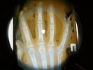 OS MUTANTES TREM FANTASMA X-RAY USSR VINYL RECORD MUSIC ON BONES ROENTGEN