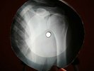 RAY CHARLES I GOT A WOMAN X-RAY USSR VINYL RECORD MUSIC ON BONES ROENTGEN
