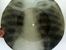 X-RAY 78rpm 10
