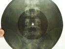 X-RAY 78rpm OCHI CHERNYE in Jazz style USSR ROENTGEN BONES RECORD Spine 1950s