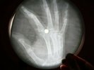 ARMSTRONG BLACK AND BLUE X-RAY USSR VINYL RECORD MUSIC ON BONES ROENTGEN