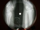 CHAMPS TEQUILA X-RAY USSR VINYL RECORD MUSIC ON BONES ROENTGEN