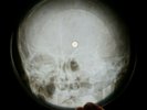 ZEPPELIN HEARTBREAKER X-RAY USSR VINYL RECORD MUSIC ON BONES ROENTGEN