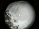 ROLLING STONES SYMPATHY FOR THE X-RAY USSR VINYL RECORD MUSIC ON BONES ROENTGEN