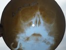 ROLLING STONES - POISON IVY - UNIQUE USSR GEORGIAN X-RAY ROENTGEN SKULL RECORD