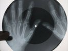 Beatles - If I Fell  X-RAY OF THE USSR BONE X-RAY RECORDING  8.7