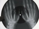 Doors - Blue Sunday X-RAY OF THE USSR BONE X-RAY RECORDING  8.5
