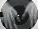 Doors - My Eyes Have Seen You X-RAY OF THE USSR BONE X-RAY RECORDING 8.7