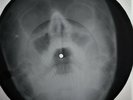 Doors - Light My Fire  X-RAY OF THE USSR BONE X-RAY RECORDING 9,2