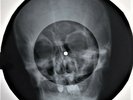 Shadows - Apache  X-RAY OF THE USSR BONE X-RAY RECORDING  9.0