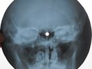 DOORS - TAKE IT AS IT COMES - USSR GEORGIAN UNIQUE X-RAY ROENTGEN SKULL RECORD