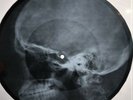 Doors - Indian Summer  X-RAY OF THE USSR BONE X-RAY RECORDING  9.1