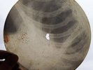 USSR - GEORGIAN / SOVIET  X-RAY ROENTGEN RECORD