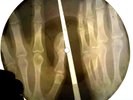 USSR PICTURE RECORD  / SOVIET  X-RAY ROENTGEN RECORD